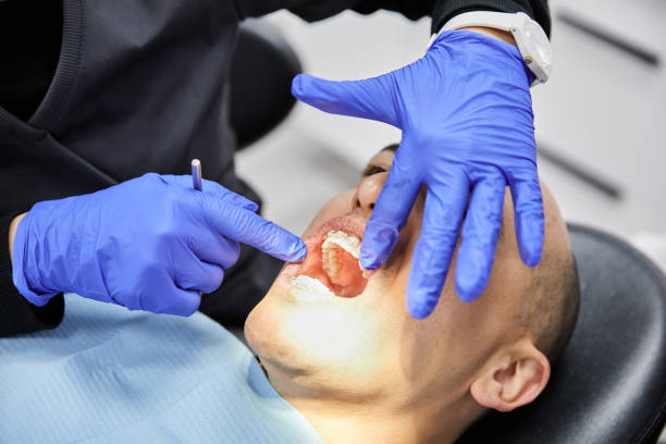 Best Emergency Wisdom Teeth Removal in Fellsmere, FL